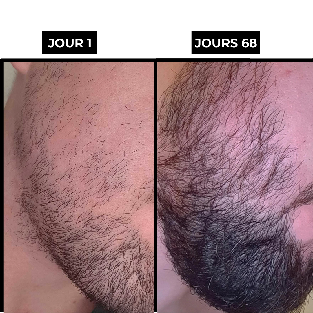 BeardKit®
