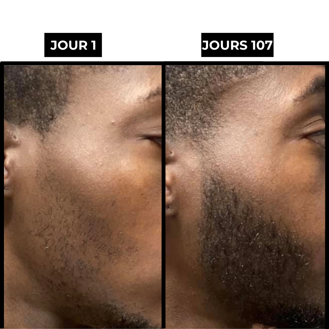 BeardKit®