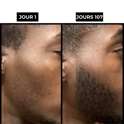 BeardKit®